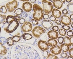 TOMM20 Antibody (ST04-72), Novus Biologicals 100&mu;L:Antibodies, Monoclonal