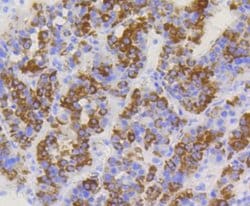 TOMM20 Antibody (ST04-72), Novus Biologicals 100&mu;L:Antibodies, Monoclonal