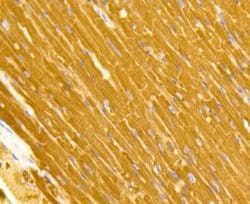 TOMM20 Antibody (ST04-72), Novus Biologicals 100&mu;L:Antibodies, Monoclonal