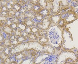 TOMM20 Antibody (ST04-72), Novus Biologicals 100&mu;L:Antibodies, Monoclonal