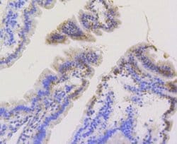 TOMM20 Antibody (ST04-72), Novus Biologicals 100&mu;L:Antibodies, Monoclonal