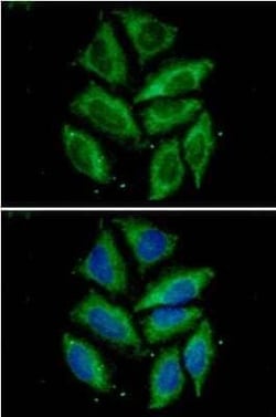 TOMM20 Mouse anti-Human, Clone: 1B2, Novus Biologicals:Antibodies:Primary