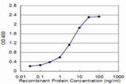 TOMM20 Antibody (4F3), Novus Biologicals 0.1 mg; Unconjugated:Antikörper