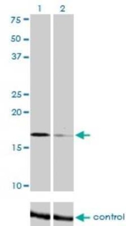 TOMM22 Antibody (4G4), Novus Biologicals 0.1 mg | Buy Online | Novus Biologicals | Fisher Scientific