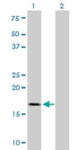 TOMM22 Antibody (4G4), Novus Biologicals 0.1 mg | Buy Online | Novus Biologicals | Fisher Scientific