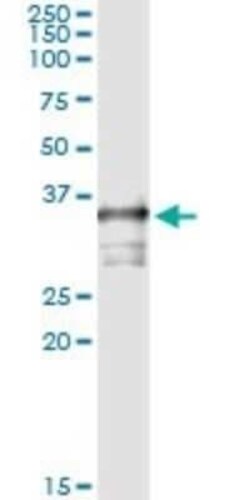 TOMM34 Antibody (1D2), Novus Biologicals 0.1 mg | Buy Online | Novus Biologicals | Fisher Scientific