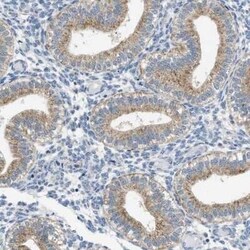 TOMM34 Antibody, Novus Biologicals 25 &mu;L; Unconjugated:Antibodies, Polyclonal