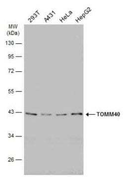 TOMM40 Antibody, Novus Biologicals 100 &mu;g | Buy Online | Bio-Techne | Fisher Scientific
