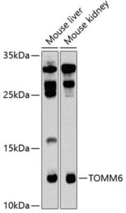 TOMM6 Antibody - BSA Free, Novus Biologicals 0.02 mL, Unconjugated:Antibodies,