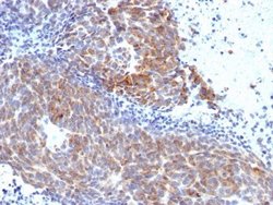 TOP1MT Antibody (TOP1MT/568) - Azide and BSA Free, Novus Biologicals 100 &mu;g | Buy Online | Novus Biologicals | Fisher Scientific