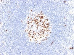 TOP2A Antibody (TOP2A/4397R) - Azide and BSA Free, Novus Biologicals 100 &mu;g | Buy Online | Novus Biologicals | Fisher Scientific