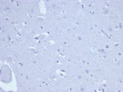 TOP2A Antibody (TOP2A/6570R) - Azide and BSA Free, Novus Biologicals 100