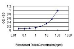 TOP2A Antibody (1E2), Novus Biologicals 0.1 mg | Buy Online | Novus Biologicals | Fisher Scientific