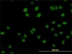 TOPORS Antibody (5G11), Novus Biologicals 0.1 mg | Buy Online | Novus Biologicals | Fisher Scientific