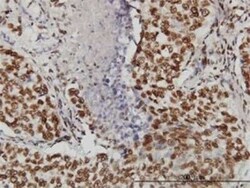 TOPORS Antibody (5G11), Novus Biologicals 0.1 mg | Buy Online | Novus Biologicals | Fisher Scientific