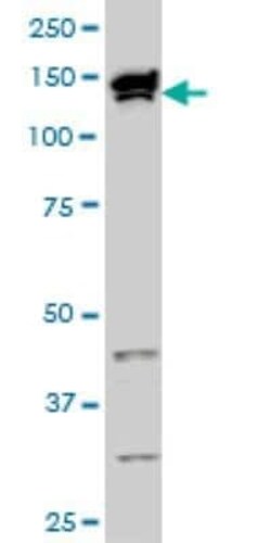 TOPORS Antibody (5G11), Novus Biologicals 0.1 mg | Buy Online | Novus Biologicals | Fisher Scientific