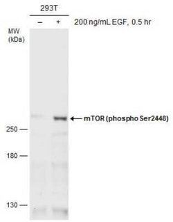 TOR/mTOR, p Ser2448 Antibody, Novus Biologicals 100 &mu;g; Unconjugated:Antikroppar