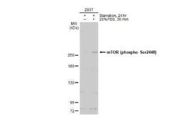 TOR/mTOR, p Ser2448 Antibody, Novus Biologicals 100 &mu;g; Unconjugated:Antikroppar
