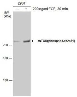 TOR/mTOR, p Ser2481 Antibody, Novus Biologicals 100 &mu;g; Unconjugated:Antibodies,