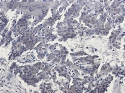 TORC2 Antibody (S08-5F2), Novus Biologicals 50 &mu;g; Unconjugated:Antibodies,