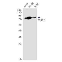 TORC2 Antibody (S08-5F2), Novus Biologicals 50 &mu;g; Unconjugated:Antibodies,