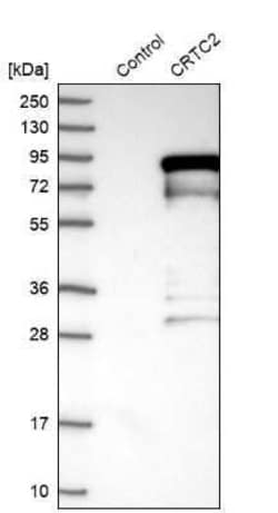 TORC2 Antibody, Novus Biologicals 0.1 mL; Unconjugated:Antibodies, Polyclonal