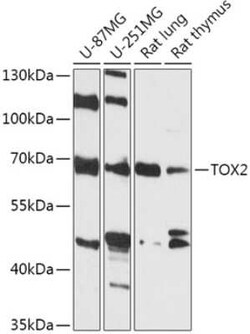 TOX2 Antibody - Azide and BSA Free, Novus Biologicals 0.02 mL; Unconjugated:Antibodies,