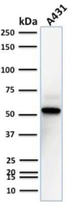 TOX3 Antibody (TOX3/1123), Novus Biologicals:Antibodies:Primary Antibodies