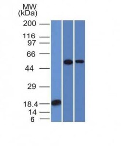 TOX3 Antibody (TOX3/1124), Novus Biologicals:Antibodies:Primary Antibodies