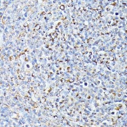 TP53I11 Antibody - Azide and BSA Free, Novus Biologicals:Antibodies:Primary