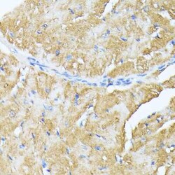 TP53I11 Antibody - Azide and BSA Free, Novus Biologicals:Antibodies:Primary