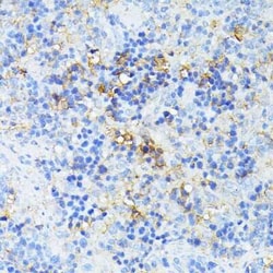 TP53I11 Antibody - Azide and BSA Free, Novus Biologicals:Antibodies:Primary