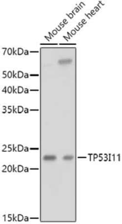 TP53I11 Antibody - Azide and BSA Free, Novus Biologicals:Antibodies:Primary