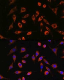 TP53I13 Antibody - Azide and BSA Free, Novus Biologicals 0.02 mL; Unconjugated:Antibodies,