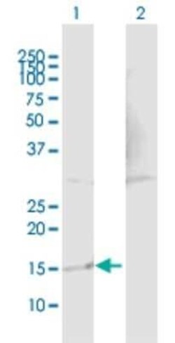 TP53TG1 Antibody, Novus Biologicals 0.05 mg | Buy Online | Novus Biologicals | Fisher Scientific