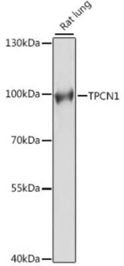 TPCN1 Antibody - Azide and BSA Free, Novus Biologicals 0.1 mL; Unconjugated:Antibodies,