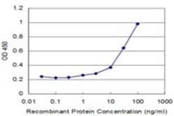 TPD52 Antibody (1B6), Novus Biologicals 0.1 mg, Unconjugated:Antibodies,