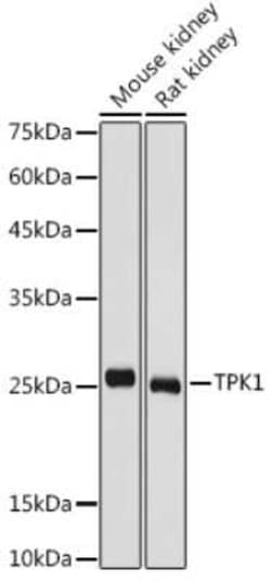 TPK1 Antibody - BSA Free, Novus Biologicals 0.1 mL, Unconjugated:Antibodies,