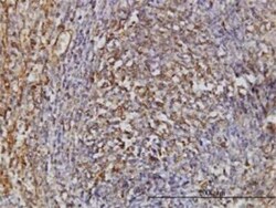 TPMT Antibody (1B5), Novus Biologicals 0.1 mg, Unconjugated:Antibodies,
