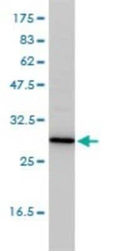 TPMT Antibody (1B5), Novus Biologicals 0.1 mg, Unconjugated:Antibodies,