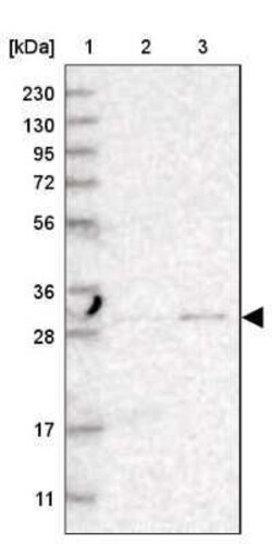 TPMT Antibody, Novus Biologicals:Antibodies:Primary Antibodies