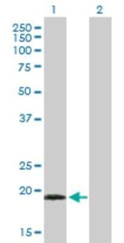 Novus Biologicals TPPP3 Antibody, Novus Biologicals 0.05 mg | Buy Online | Novus Biologicals&trade; | Fisher Scientific