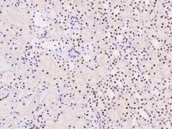 TPRX1 Antibody, Novus Biologicals 100 &mu;g | Buy Online | Novus Biologicals | Fisher Scientific