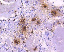Tryptase alpha/TPS1 Rabbit anti-Human, Mouse, Rat, Clone: SC68-07, Novus
