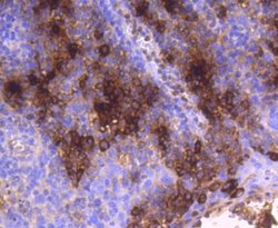 Tryptase alpha/TPS1 Rabbit anti-Human, Mouse, Rat, Clone: SC68-07, Novus