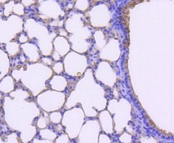 Tryptase alpha/TPS1 Rabbit anti-Human, Mouse, Rat, Clone: SC68-07, Novus