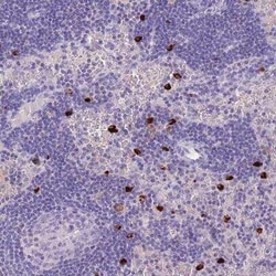 TPSD1 Antibody, Novus Biologicals:Antibodies:Primary Antibodies