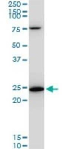 TPT1/TCTP Antibody (2A3), Novus Biologicals 0.1 mg | Buy Online | Novus Biologicals | Fisher Scientific