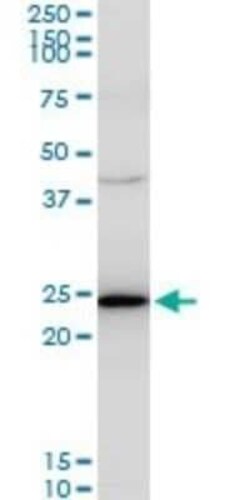 TPT1/TCTP Antibody (2A3), Novus Biologicals 0.1 mg | Buy Online | Novus Biologicals | Fisher Scientific