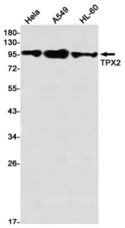 TPX2 Antibody (S01-8A6), Novus Biologicals 100 &mu;g; Unconjugated:Antibodies,